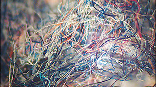 Mysterious Magenta Fibers Crawling Out Of Your Skin? You're <i>Not Alone!</i>